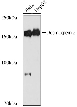 Desmoglein 2 Rabbit Monoclonal Antibody