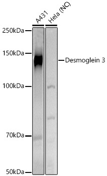 Desmoglein 3 Rabbit Polyclonal Antibody