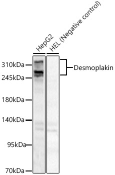 Desmoplakin Rabbit Polyclonal Antibody
