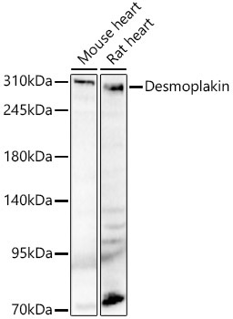 Desmoplakin Rabbit Polyclonal Antibody - Image 2