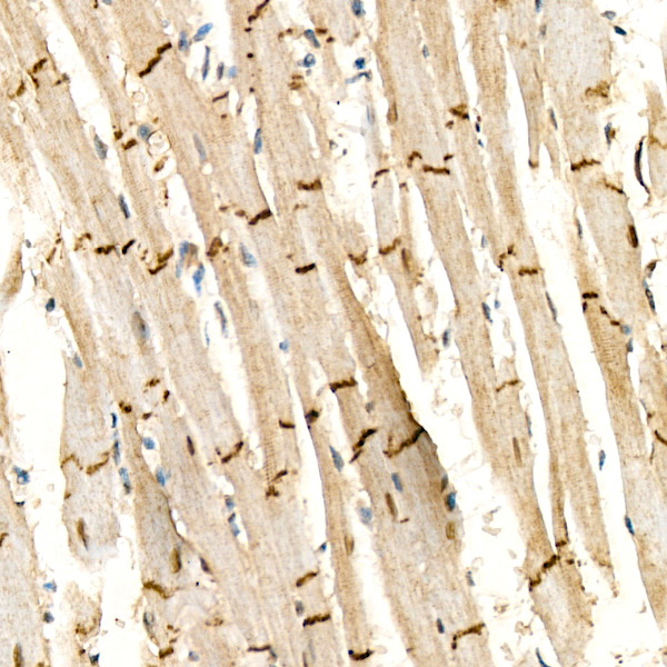 Desmoplakin Rabbit Polyclonal Antibody - Image 3