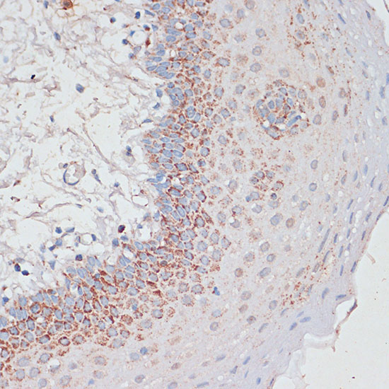 Desmoplakin Rabbit Polyclonal Antibody - Image 2