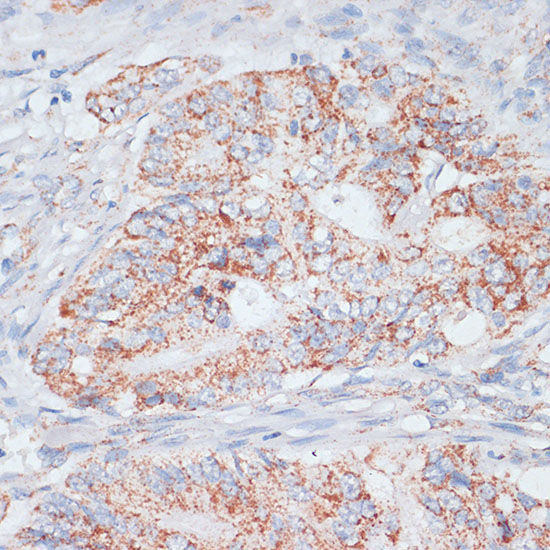 Desmoplakin Rabbit Polyclonal Antibody - Image 3