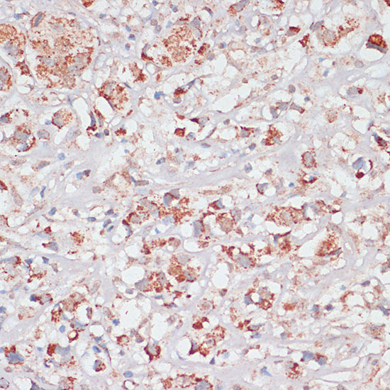 Desmoplakin Rabbit Polyclonal Antibody - Image 4