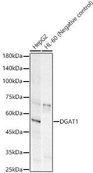 DGAT1 Rabbit Monoclonal Antibody