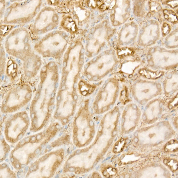 DGAT1 Rabbit Monoclonal Antibody - Image 2