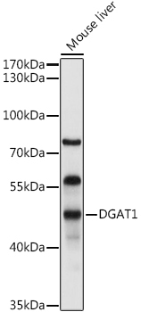 DGAT1 Rabbit Polyclonal Antibody - Image 2
