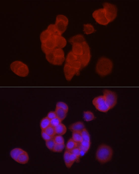 DGAT1 Rabbit Polyclonal Antibody - Image 3