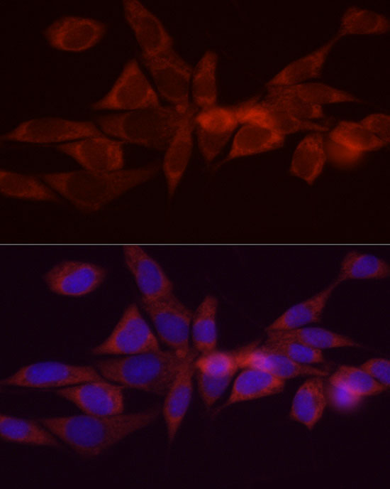 DGAT1 Rabbit Polyclonal Antibody - Image 4