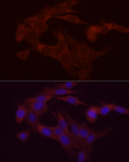 DGAT1 Rabbit Polyclonal Antibody - Image 5