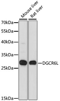 DGCR6L Rabbit Polyclonal Antibody