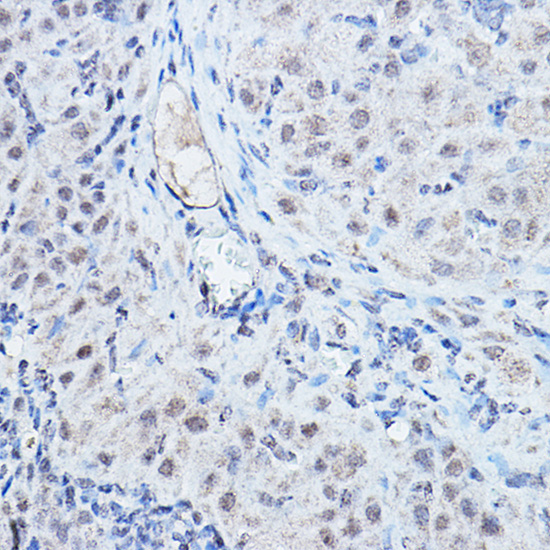 DGCR8 Rabbit Polyclonal Antibody - Image 2