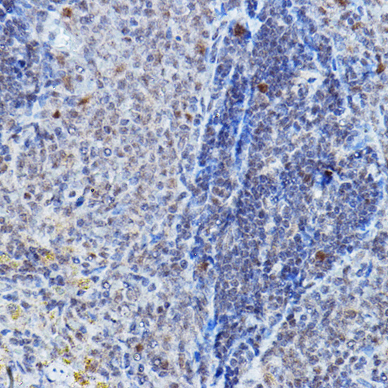 DGCR8 Rabbit Polyclonal Antibody - Image 3