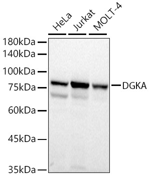 DGKA Rabbit Polyclonal Antibody