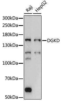 DGKD Rabbit Polyclonal Antibody