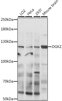 DGKZ Rabbit Polyclonal Antibody