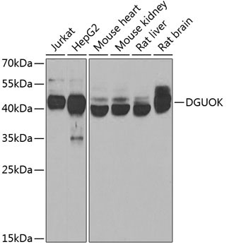 DGUOK Rabbit Polyclonal Antibody