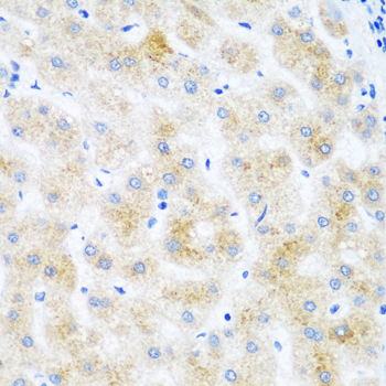 DHODH Rabbit Polyclonal Antibody - Image 2