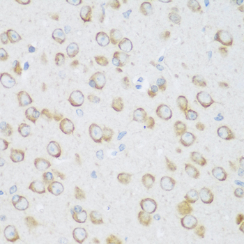 DHODH Rabbit Polyclonal Antibody - Image 4
