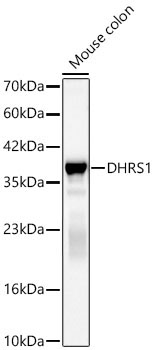 DHRS1 Rabbit Polyclonal Antibody