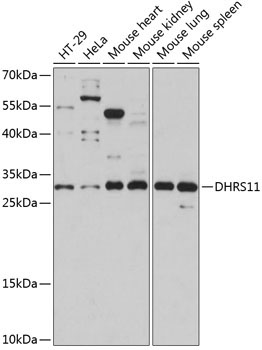 DHRS11 Rabbit Polyclonal Antibody