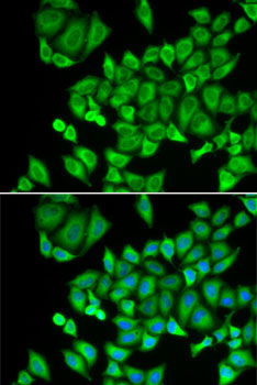 DHRS9 Rabbit Polyclonal Antibody - Image 3