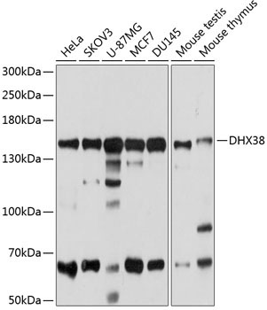 DHX38 Rabbit Polyclonal Antibody