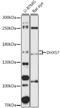 DHX57 Rabbit Polyclonal Antibody