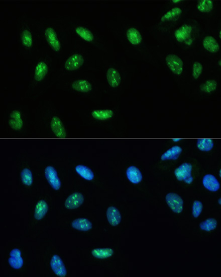 DHX9/RNA Helicase A Rabbit Polyclonal Antibody - Image 2