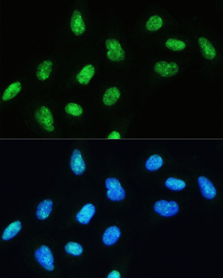 DHX9/RNA Helicase A Rabbit Polyclonal Antibody - Image 3