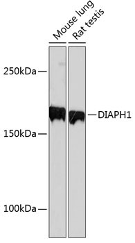 DIAPH1 Rabbit Monoclonal Antibody