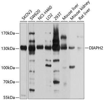 DIAPH2 Rabbit Polyclonal Antibody