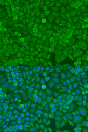 DICER1 Rabbit Polyclonal Antibody