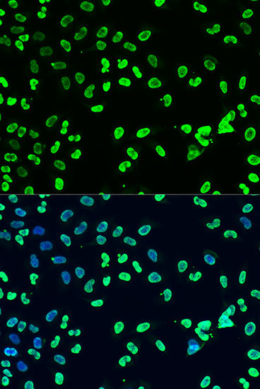 DiMethyl-DNMT3A-K44 Rabbit Polyclonal Antibody