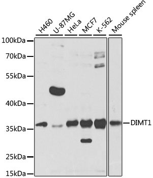 DIMT1 Rabbit Polyclonal Antibody