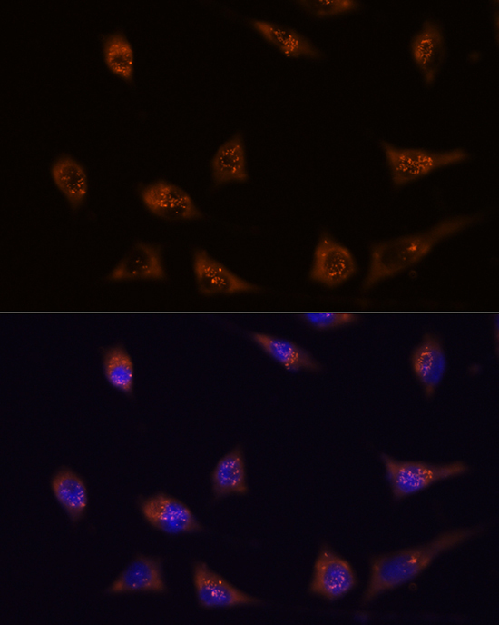 DIP2C Rabbit Polyclonal Antibody - Image 2