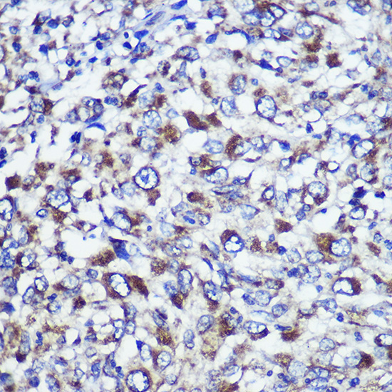 DIS3L Rabbit Polyclonal Antibody - Image 2