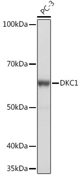 DKC1 Rabbit Monoclonal Antibody