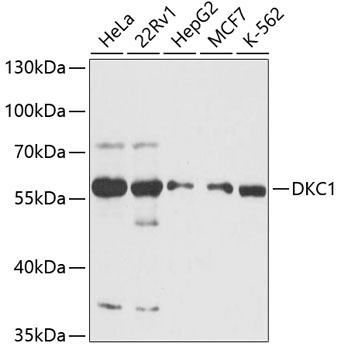 DKC1 Rabbit Polyclonal Antibody