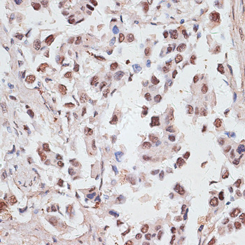 DKC1 Rabbit Polyclonal Antibody - Image 2