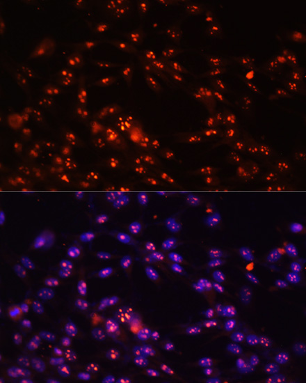 DKC1 Rabbit Polyclonal Antibody - Image 3