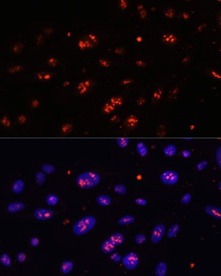 DKC1 Rabbit Polyclonal Antibody - Image 4
