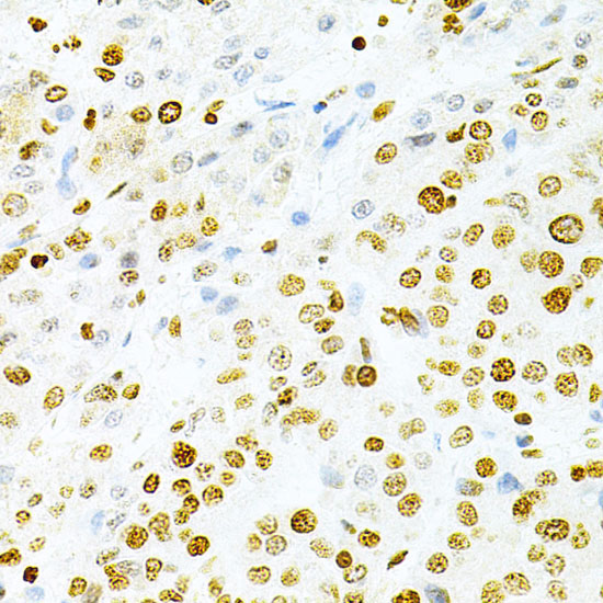 DKC1 Rabbit Polyclonal Antibody