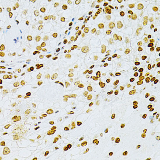 DKC1 Rabbit Polyclonal Antibody - Image 2
