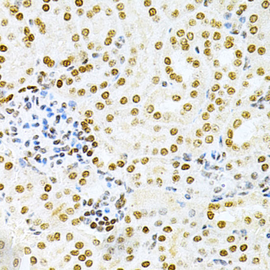 DKC1 Rabbit Polyclonal Antibody - Image 3
