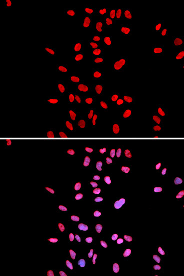 DKC1 Rabbit Polyclonal Antibody - Image 4