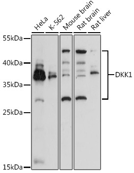 DKK1 Rabbit Polyclonal Antibody