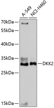 DKK2 Rabbit Polyclonal Antibody