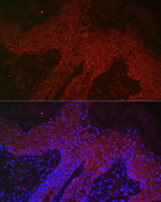 DKK2 Rabbit Polyclonal Antibody - Image 2