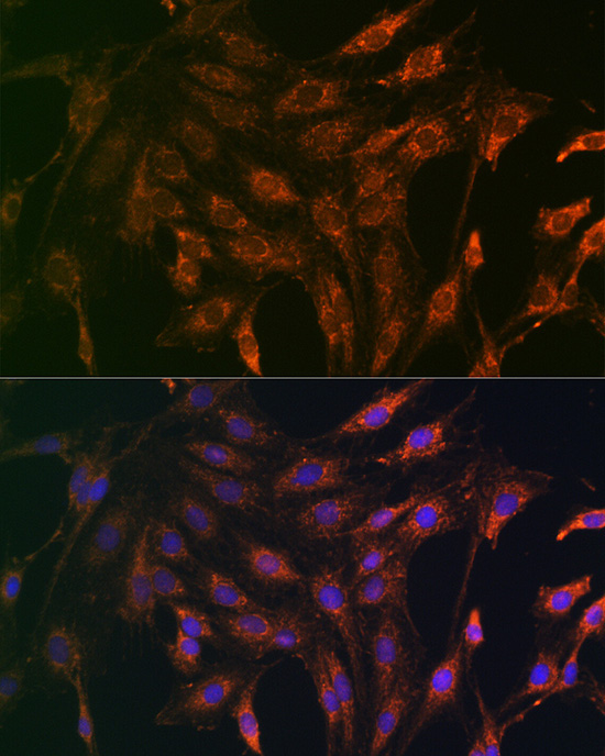 DKK3 Rabbit Polyclonal Antibody - Image 3
